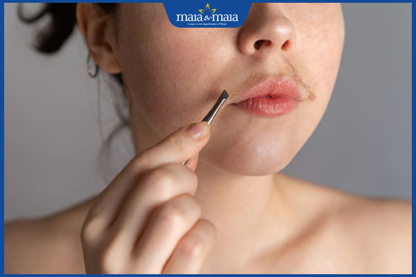 phụ nữ nhiều ria mép