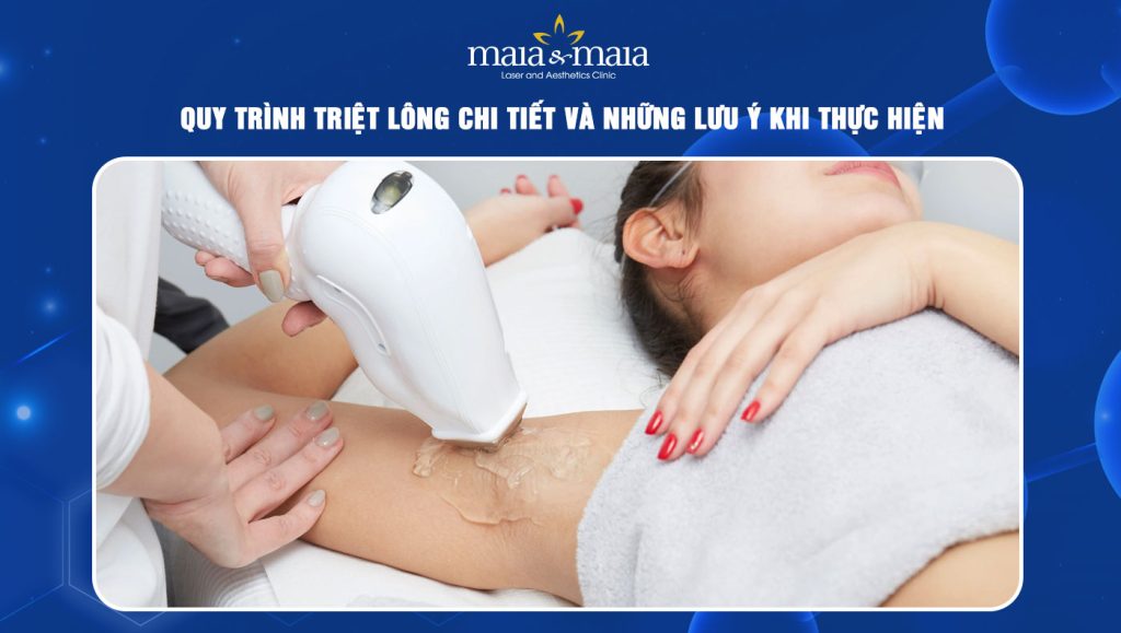 quy trình triệt lông