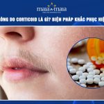 rậm lông do corticoid