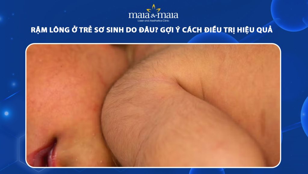 rậm lông ở trẻ sơ sinh
