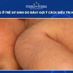 rậm lông ở trẻ sơ sinh