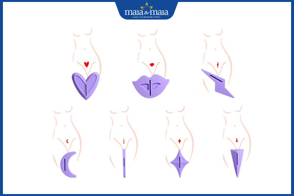 tạo hình lông vùng kín