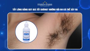 Tẩy lông bằng oxy già tốt không? Những rủi ro có thể xảy ra 92 tẩy lông bằng oxy già