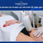 tẩy lông vùng kín bao lâu thì mọc lại