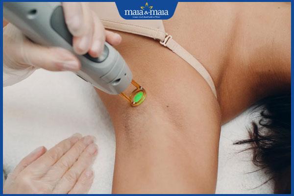 Triệt lông bằng laser gây ung thư không? Tác dụng phụ mọi người nên lưu ý 2 thực hiện triệt lông bằng laser