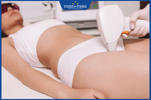 Giải đáp thắc mắc nên wax hay triệt lông bikini? 3 thực hiện triệt lông bikini