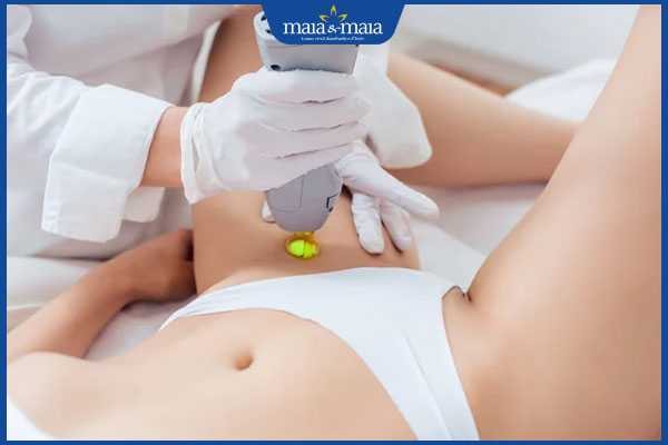 Kinh nghiệm triệt lông vùng kín đảm bảo an toàn và hiệu quả 2 tiến hành triệt lông vùng kín