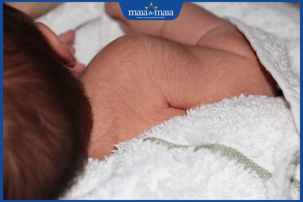 trẻ sơ sinh rậm lông