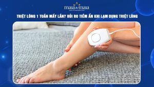 Triệt lông 1 tuần mấy lần? Rủi ro tiềm ẩn khi lạm dụng triệt lông 53 Triệt lông 1 tuần mấy lần