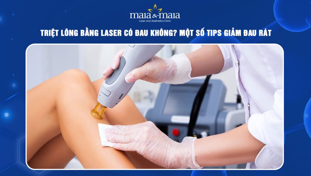 Triệt lông bằng laser có đau không