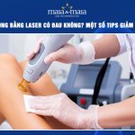 Triệt lông bằng laser có đau không