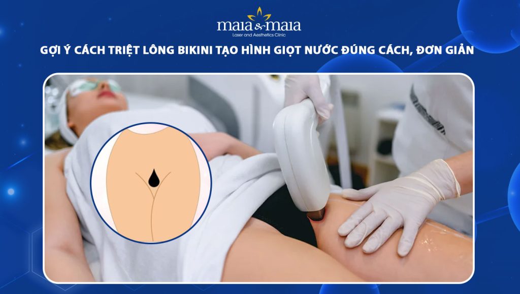 triệt lông bikini tạo hình giọt nước