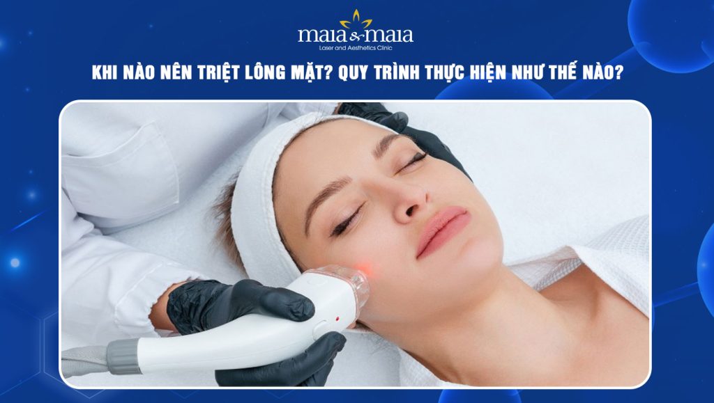 Khi nào nên triệt lông mặt? Quy trình thực hiện như thế nào? 1 triệt lông mặt