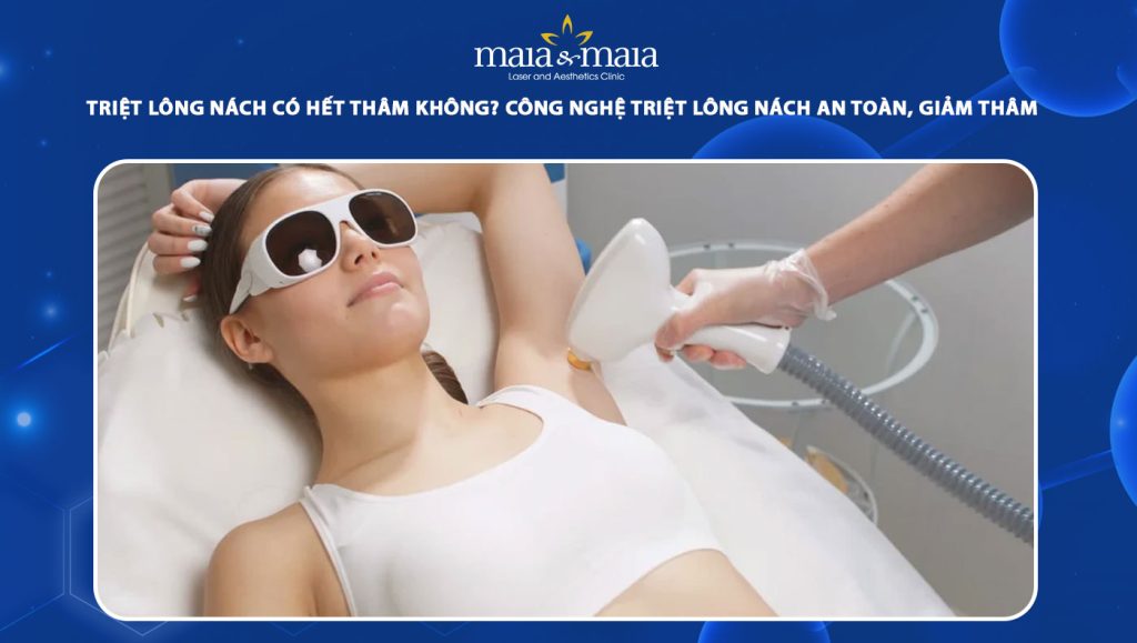 triệt lông nách có hết thâm không