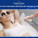 triệt lông nách có hết thâm không