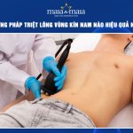 triệt lông vùng kín nam