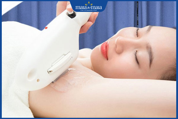 Tổng hợp các cách làm nách hết sần sùi, thâm sạn hiệu quả 5 triệt lông vùng nách vĩnh viễn