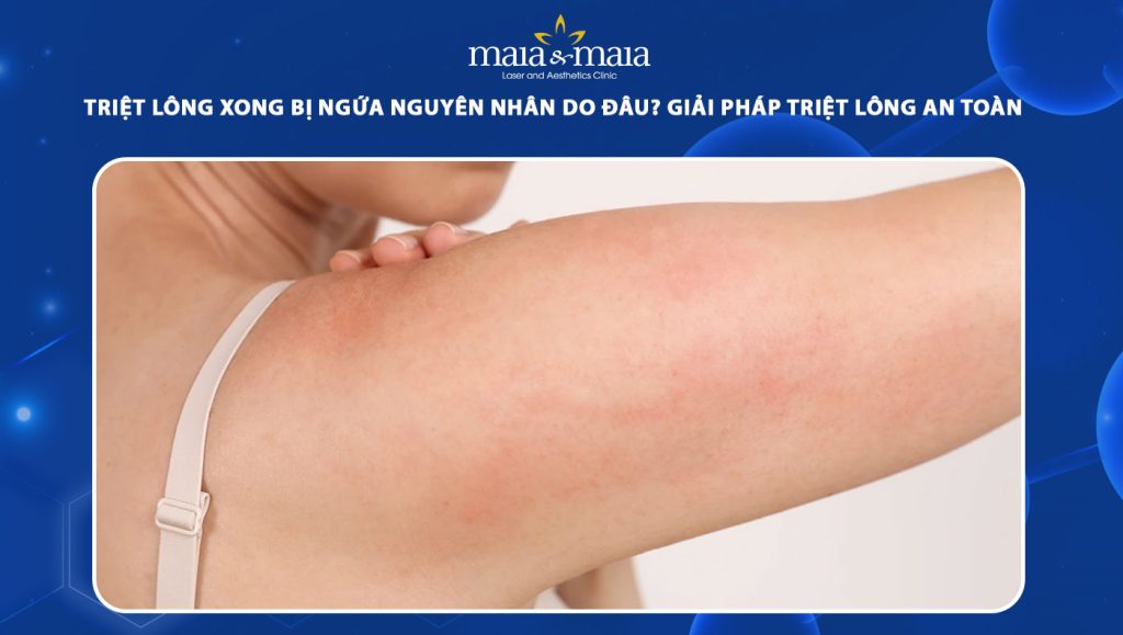 triệt lông xong bị ngứa nguyên nhân do đâu