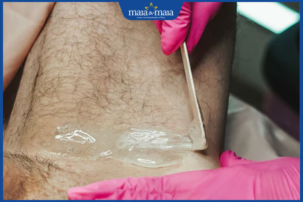 Phương pháp triệt lông vùng kín nam nào hiệu quả nhất? 4 wax vùng kín nam