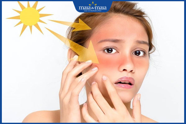 bảo vệ da khỏi ánh nắng