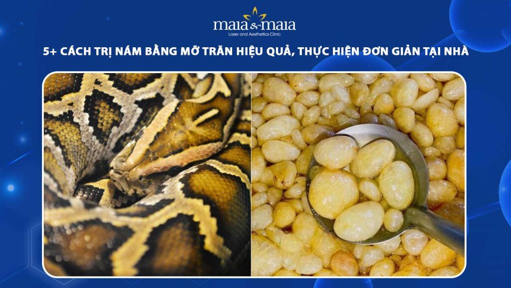 cách trị nám bằng mỡ trăn