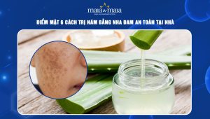 Điểm mặt 6 cách trị nám bằng nha đam an toàn tại nhà 104 cách trị nám bằng nha đam