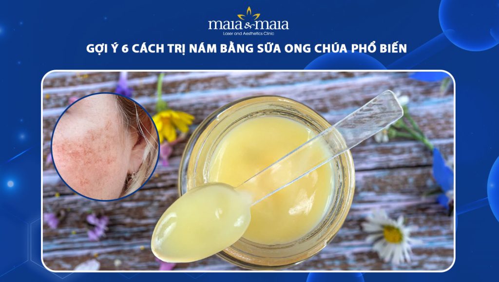 cách trị nám bằng sữa ong chúa