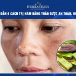 cách trị nám bằng thảo dược