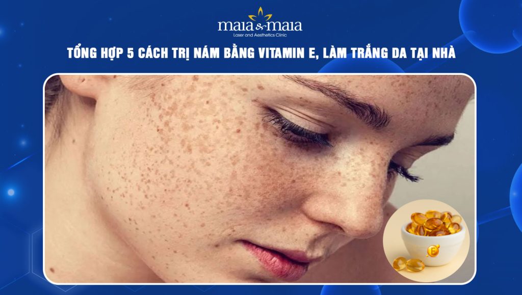cách trị nám bằng vitamin e