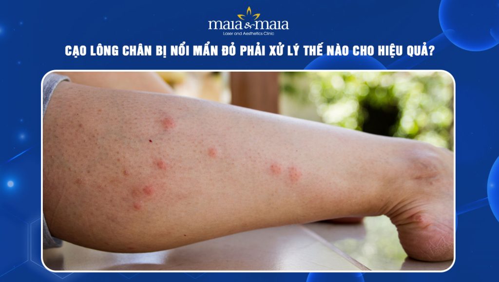 cạo lông chân bị nổi mẩn đỏ