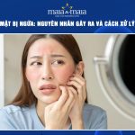 cạo lông mặt bị ngứa