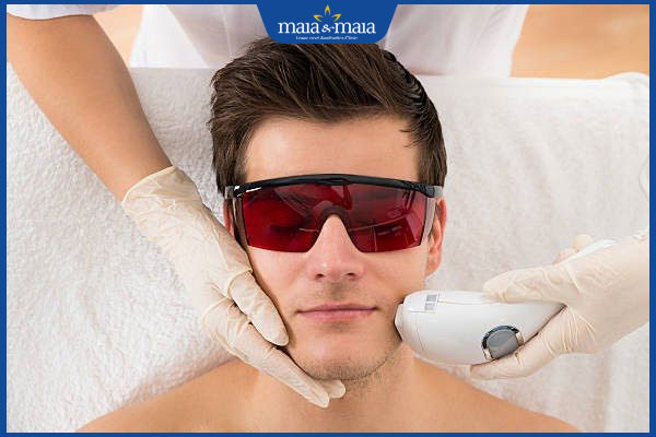 3 phương pháp triệt lông mặt vĩnh viễn cho nam hiệu quả, an toàn 5 chi phí triệt lông mặt cho nam