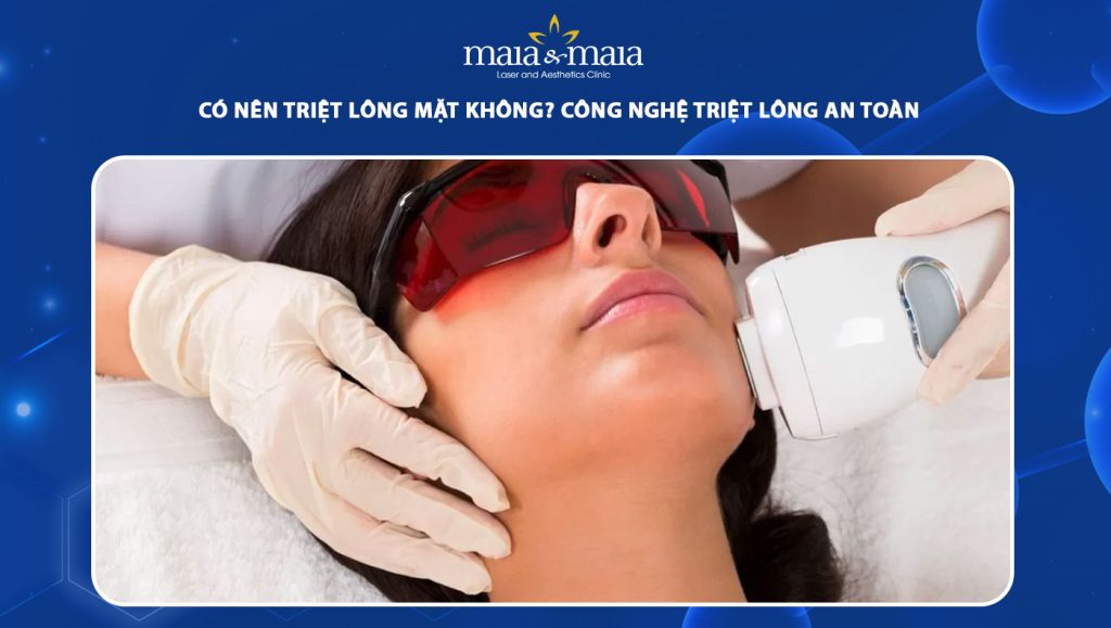 Có nên triệt lông mặt không? Công nghệ triệt lông an toàn 1 có nên triệt lông mặt không