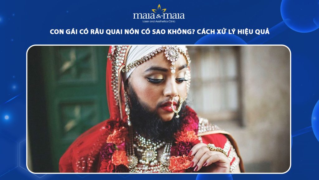 Con gái có râu quai nón có sao không? Cách xử lý hiệu quả 1 con gái có râu quai nón