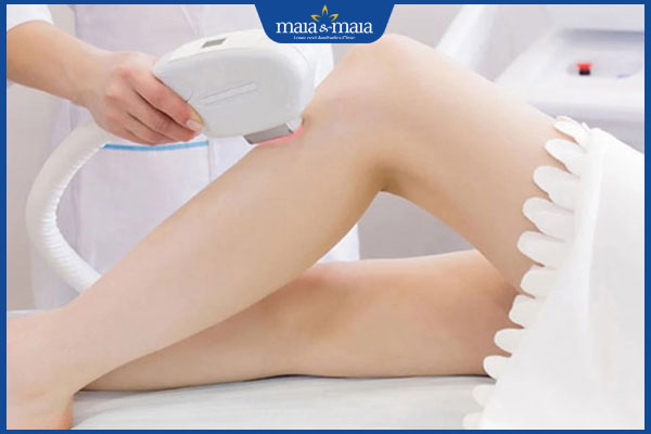 công nghệ cao triệt lông chân