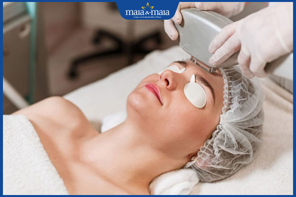 Giải đáp chi tiết: Triệt lông mặt vĩnh viễn giá bao nhiêu? 2 công nghệ triệt lông mặt