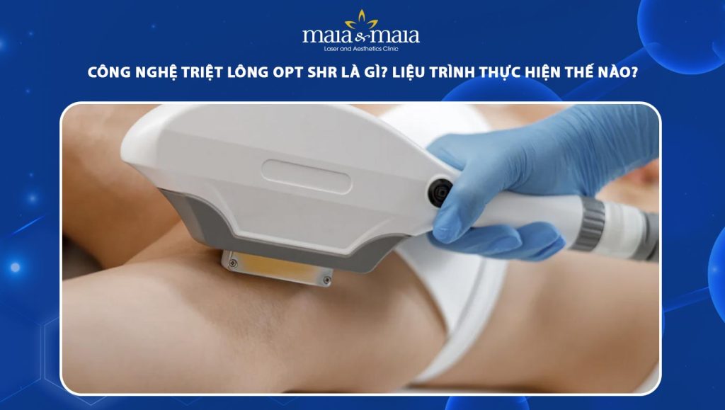 công nghệ triệt lông opt shr
