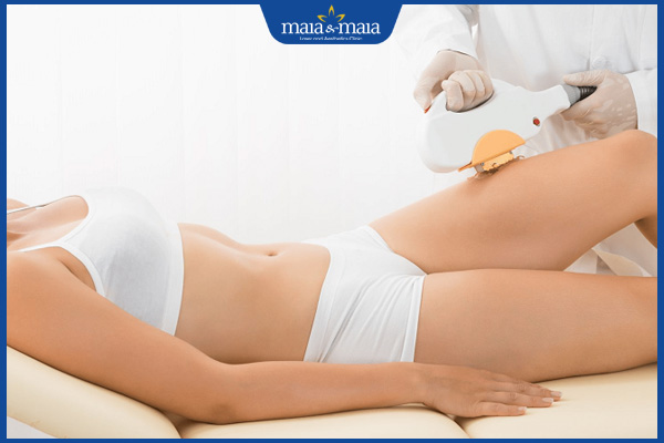 công nghệ triệt lông toàn thân