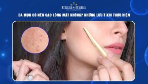 Da mụn có nên cạo lông mặt không? Những lưu ý khi thực hiện  91 da mụn có nên cạo lông mặt không