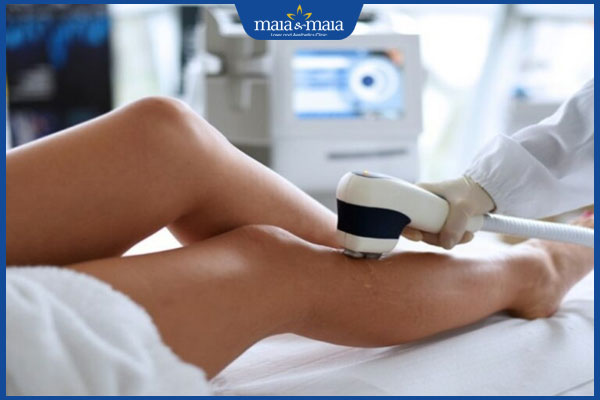 định nghĩa công nghệ opt shr