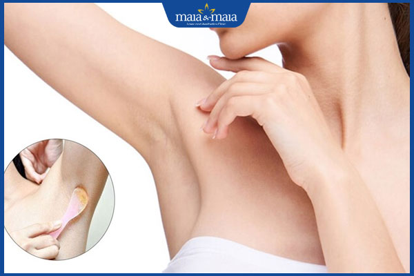 hiệu quả tẩy lông nách bằng mật ong