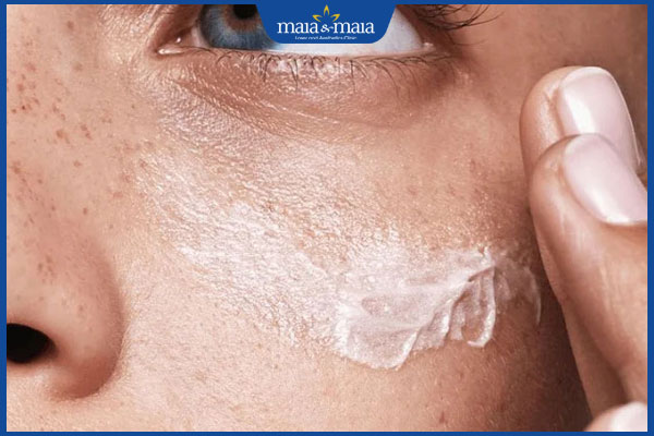 kem dưỡng da nám