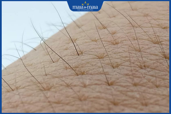 Có nên cạo lông chân ở tuổi dậy thì không? Lưu ý khi dọn lông chân 2 lông chân mọc nhiều ở tuổi dậy thì