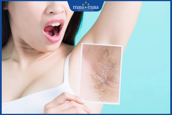Bật mí cách triệt lông nách ở tuổi dậy thì hiệu quả, an toàn 2 lông nách tuổi dậy thì
