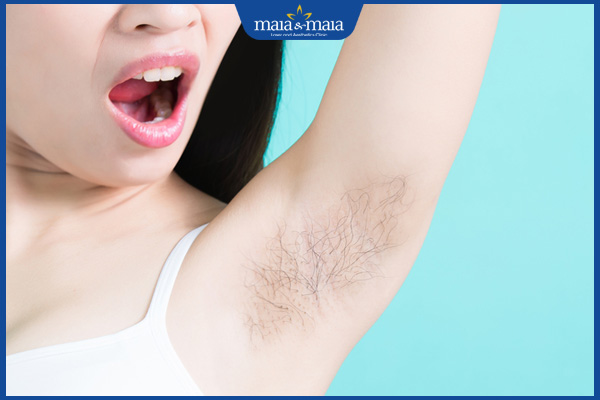 Mỗi lần triệt lông nách cách nhau bao lâu? Yếu tố ảnh hưởng 2 lông nách