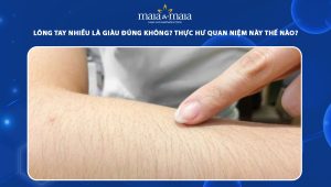 Lông tay nhiều là giàu đúng không? Thực hư quan niệm này thế nào? 83 lông tay nhiều là giàu