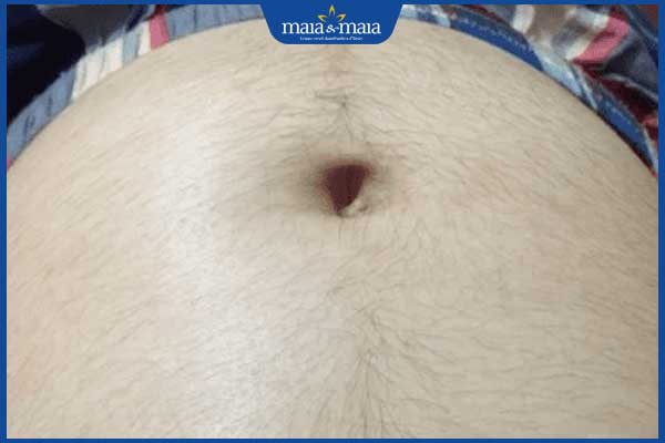 mẹ bầu nhiều lông