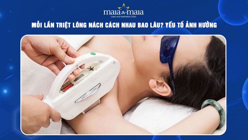 Mỗi lần triệt lông nách cách nhau bao lâu? Yếu tố ảnh hưởng 1 mỗi lần triệt lông nách cách nhau bao lâu