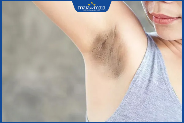 nách bị thâm sạm