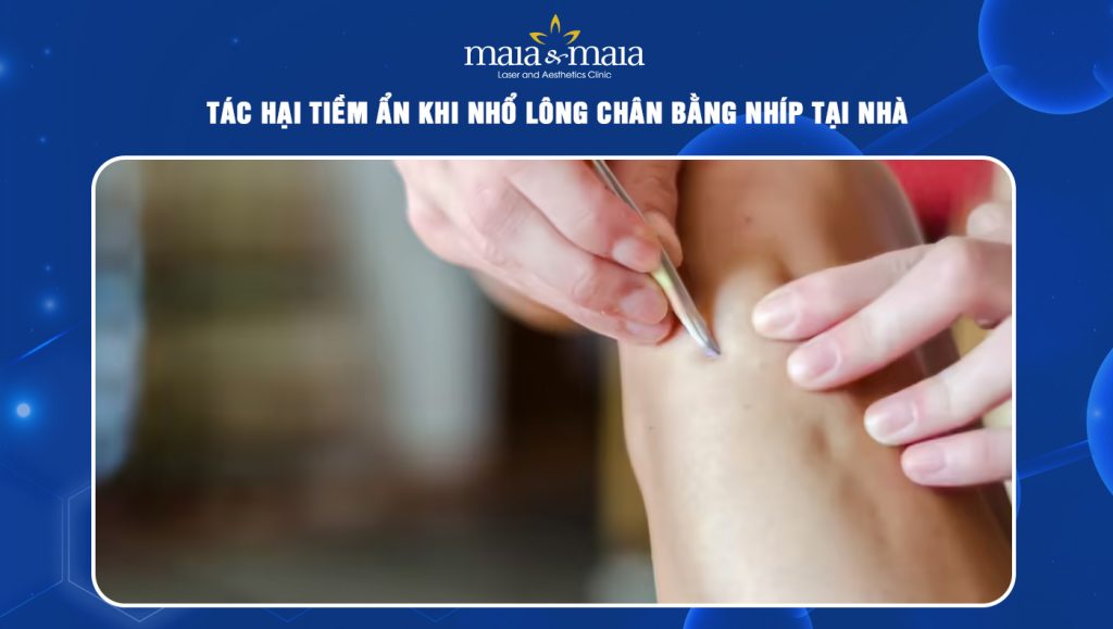 nhổ lông chân